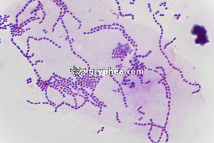 Streptocoques x800 - gryphea.org